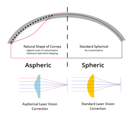 Tailored Clarity: Customized LASIK Surgery for Personalized Vision