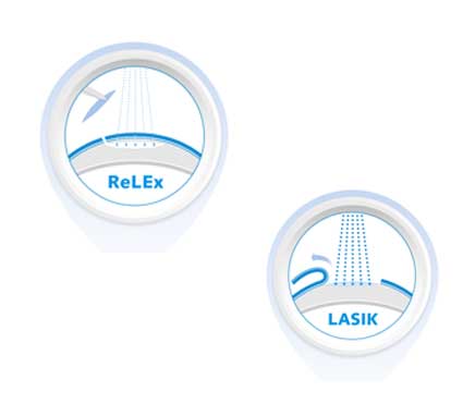 relex-smile-laser-eye-surgery-in-delhi